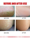 KURAIY Crack Blaster Repair - Cracked Skin, Heel, Finger Healing Balm and Crack Blaster Revive Dry Skin and Body Cream (50gm)